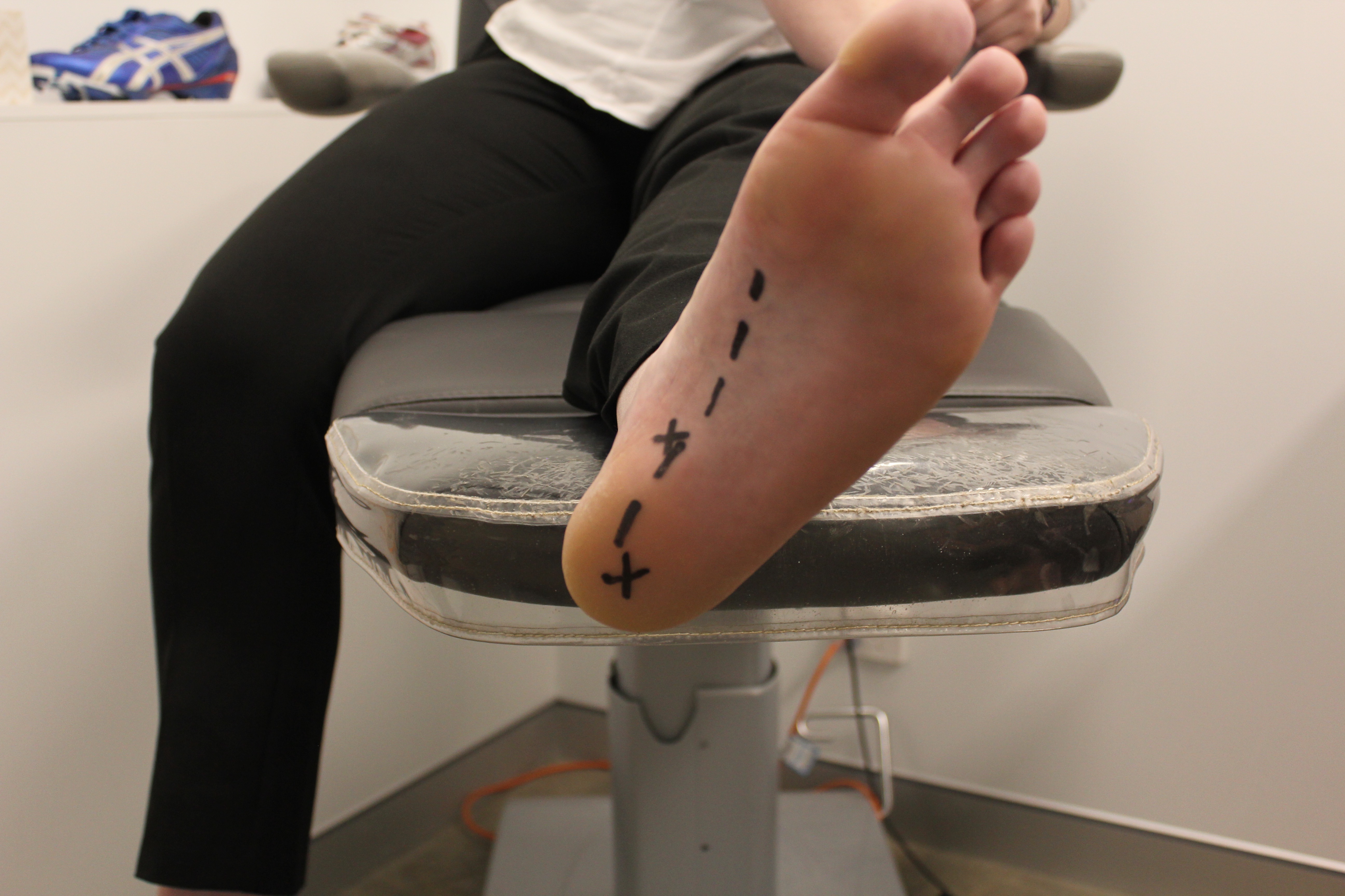 Podiatry Heel Pain