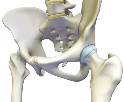 Anatomic Hip